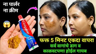 ना क्रीम ना पार्लर घरगुती पद्धतीने घालवा वांग आणि काळवटपणा 😱 kitchen tips  marathi kitchen  Tadka [upl. by Martinson]