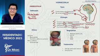 Neurocirugía  5 Hidrocefalia [upl. by Stella933]