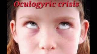 Oculogyric crisis mrcpch Communication [upl. by Najib300]