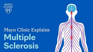 Mayo Clinic Explains Multiple Sclerosis [upl. by Noe]