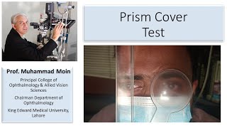 How to Perform Prism Cover Test [upl. by Hartwell]