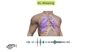 Abnormal lung sounds in COPD [upl. by Zanas]