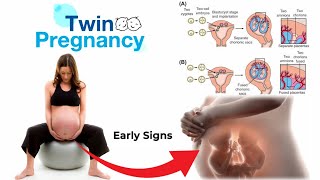 twins pregnancy  twins pregnancy week by week video  care during twin pregnancy [upl. by Alecram392]