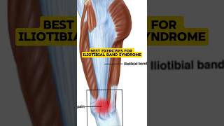 Best exercises for Iliotibial Band Syndromeleg painStrengthening of IT Bandleg by physiotherapy [upl. by Oletta234]