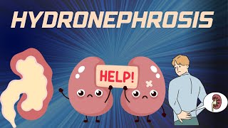 HYDRONEPHROSIS  Pathophysiology Causes signs and symptoms background diagnosis and treatment [upl. by Id]