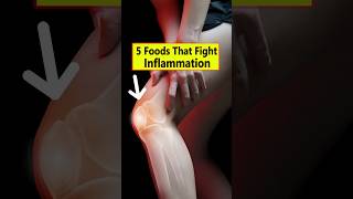 Top 5 AntiInflammatory Foods You Should Eat  Arthritishealth [upl. by Lankton]