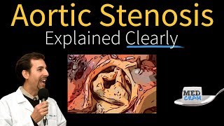 Aortic Stenosis Explained Clearly  Diagnosis and Treatment [upl. by Kendall]