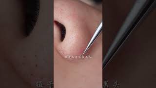 immersive skin care strawberry nose blackhead deep pore cleaning skin management [upl. by Hevak]