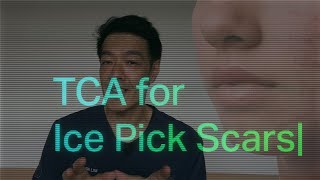 Treatments for Ice pick acne scars  Dr Davin Lim [upl. by Ayouqes]