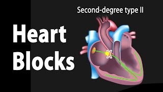 Heart Blocks Anatomy and ECG Reading Animation [upl. by Nylavad]