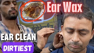 Dirtiest Ear Wax found During Ear Cleaning at Street Side Ear Cleaner  ASMR [upl. by Carothers393]