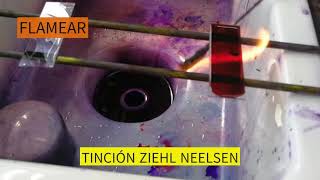 TINCION ZIEHL NEELSEN [upl. by Reppep]