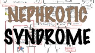 Nephrotic Syndrome  Overview Sign and symptoms pathophysiology [upl. by Nerej]