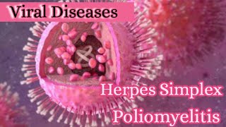 Simple explanation of Herpes virus amp Polio viruspoliomyelitisherpes simplex virusViral diseases [upl. by Schonfield396]