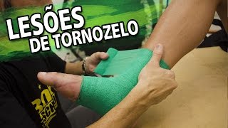 Como tratar lesões de tornozelo Fisioterapia Esportiva  RTF 111 [upl. by Aicemaj]