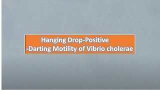 Darting motility positive Vibrio cholerae in stool of Cholera patient [upl. by Lodi]