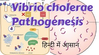 Vibrio cholerae  Pathogenesis amp clinical manifestations [upl. by Sugna]