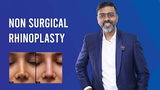 NonSurgical Rhinoplasty  Treatment Results Benefits amp Cost By Dr Sunil Richardson [upl. by Hunfredo134]