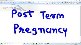 POST TERM PREGNANCY  CONCEPT MANAGEMENT [upl. by Karlan73]