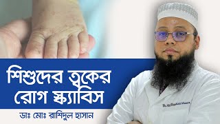 Scabies  Scabies Treatment  Scabies Symptoms  খোস পাঁচড়া ও তার প্রতিকার [upl. by Idalina]