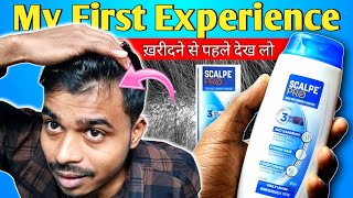 Best Dandruff Shampoo for Men  Scalpe Pro Anti Dandruff Shampoo Review⚡Daily Anti Dandruff Sampu 😇 [upl. by Waterer500]