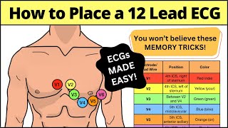 12 Lead ECG Placement MADE EASY EMT Nursing Paramedic ecg nursing [upl. by Aicnelav774]