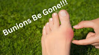 Got Bunions Find Relief With These Effective and Easy Exercises [upl. by Ennoid804]