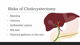 What is Laparoscopic Cholecystectomy [upl. by Nanon]