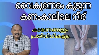 കാലത്ത് കുറയുന്ന കണങ്കാലിലെ നെരിയാണി നീര് Gravitational oedema [upl. by Spiegel]