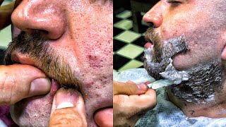 ASMR BEARD CUT • Acne removal and Turkish massage • Barber Numan [upl. by Christean]