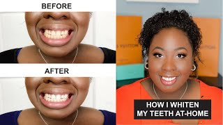 How to whiten your teeth at home  Honest Review  iSmile California [upl. by Noiram255]