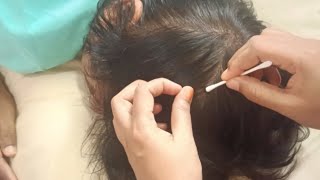 ASMR  Relaxing Scalp Searching Real Person massage Good Sleep 💤😴 303 [upl. by Silecara]