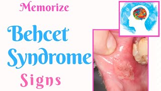 Behcet Syndrome Mnemonic [upl. by Nemzzaj]