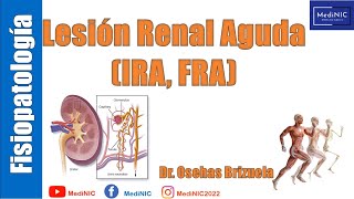 Lesión Renal Aguda Fisiopatologia y tratamiento  MediNIC [upl. by Anneirb986]