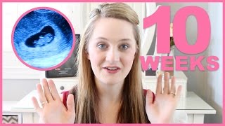 10 WEEK PREGNANCY BUMPDATE [upl. by Madelena]