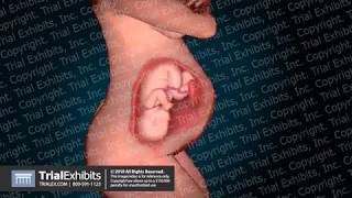 Fetal Circulation v Neonatal Circulation [upl. by Ehtylb]