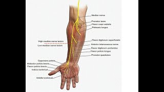 Two Minutes of Anatomy Median Nerve [upl. by Elleniad324]