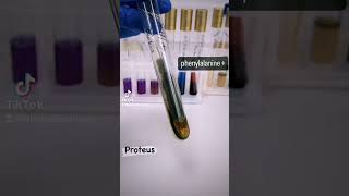 Proteus showing positive phenylalanine deamination test Microbiology medicalmicrobiology [upl. by Delanie]