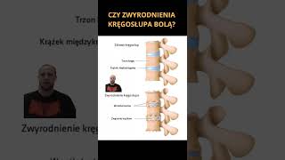 Zwyrodnienie a ból kręgosłupa pain spine physiotherapy [upl. by Drofdarb]