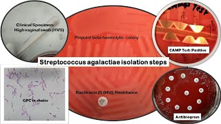 Streptococcus agalactiae Identification stepsGram stainBacitracin susceptibility CAMPAntibiogram [upl. by Sapphira843]