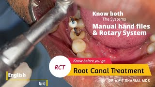 How Root canal treatment  RCT is done  Know both Manual and Rotary system [upl. by Joella417]