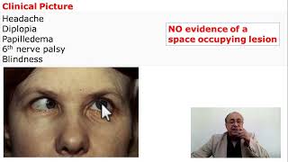 Pseudotumor Cerebri Benign increase of Intracranial Pressure [upl. by Lorola]