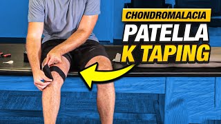 Relieve Knee Pain FAST Chondromalacia Patella K Taping [upl. by Demb]