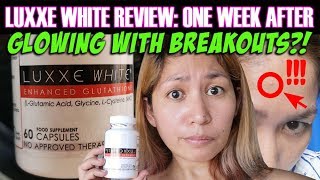 Luxxe White Glutathione 2019 Review One Week After Dami Breakouts Itutuloy ko pa ba [upl. by Delphina9]