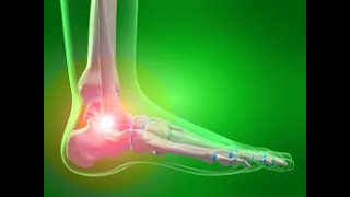 5 EXERCISES FOR ANKLE PAIN RELIEF [upl. by Korella]