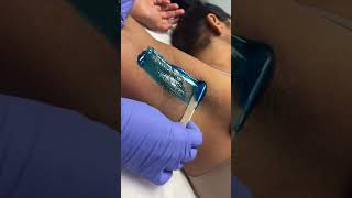 Quick professional underarm wax using hard blue wax from Starpil professional Esthetician [upl. by Etteb]