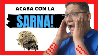 ✅DESCUBRE estas12 COSAS para APRENDER a ELIMINAR la SARNA🦔 EN MENOS DE 4 DIAS🦔 [upl. by Nylia]