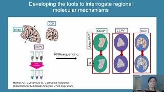 Selective Neuronal Vulnerability in Neurodegeneration [upl. by Liban]