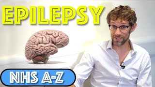 Epilepsy  What is Epilepsy and What Causes Seizures  NHS A to Z  Dr Gill [upl. by Akere]