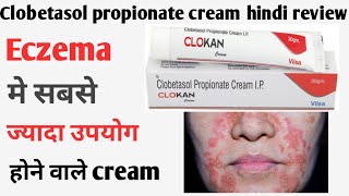 Clobetasol propionate cream ip  Clobetasol propionate cream ip uses in hindi  clokan cream hindi [upl. by Eniamert]